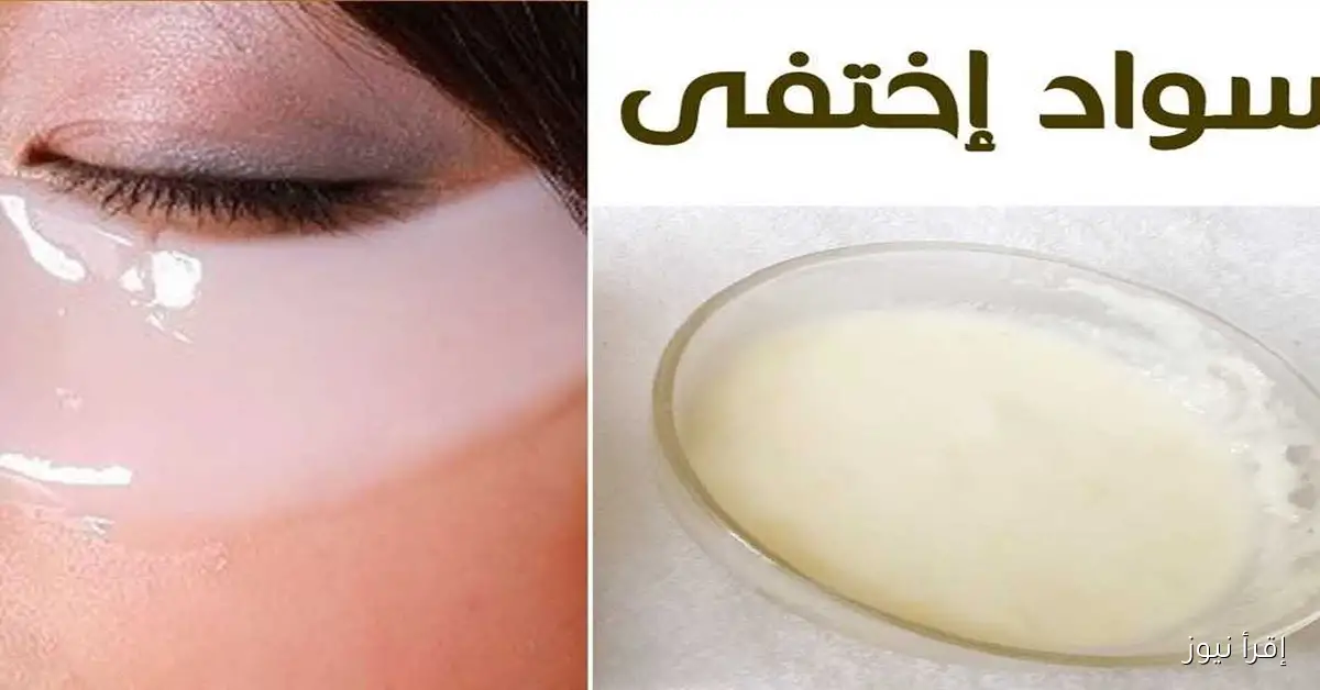 وداعًا للهالات السوداء.. ماسك طبيعي بالخيار والزبادي يحقق النتائج المذهلة